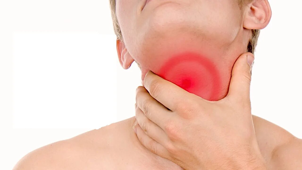 Острый тонзиллит