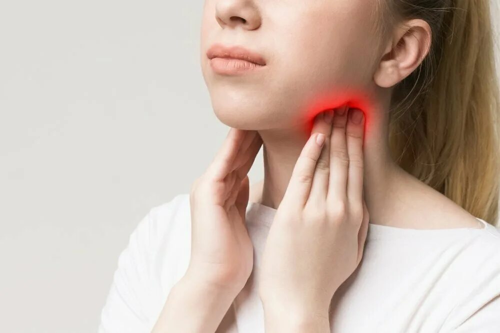 Острый тонзиллит