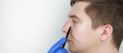 Schutz Vor St&ouml;&szlig;en Nach Einer Nasenkorrektur - Prof. Dr. Murat Songu